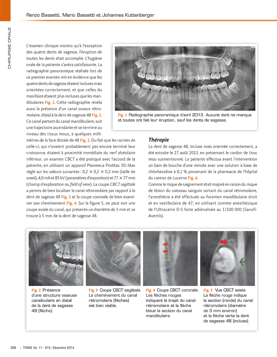 Titane - trimestrial B2B magazine of implantology - inside page